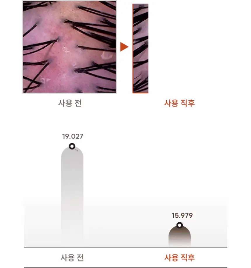 [1등 두피세럼 / 특허 맥주효모] 나인밀라 맥주효모 두피영양제 앰플 팩 120ml 단독 기획 (+샴푸 60ml 증정) 상세페이지 17